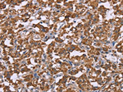 PPIF Antibody