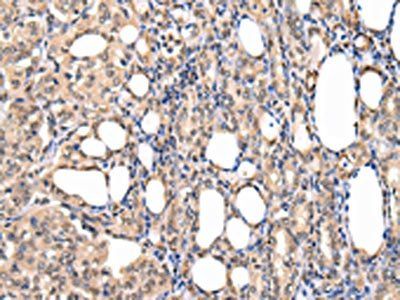 PPIL1 Antibody