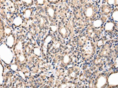 PPIL1 Antibody