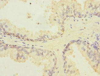PPIL2 Antibody