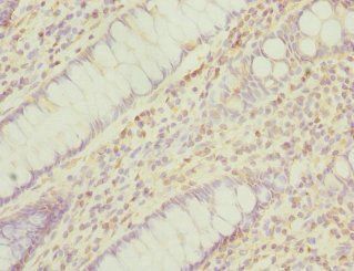 PPM1A Antibody
