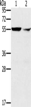 PPM1F antibody