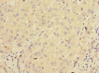 PPM1M Antibody