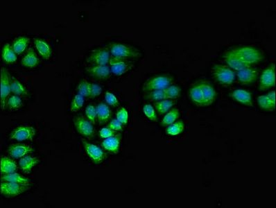 PPOX Antibody