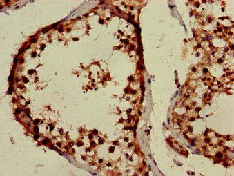 PPOX Antibody
