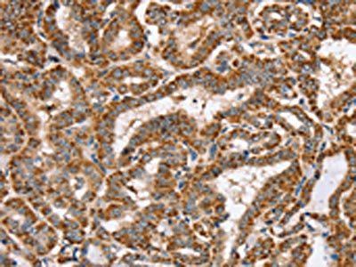 PPOX Antibody