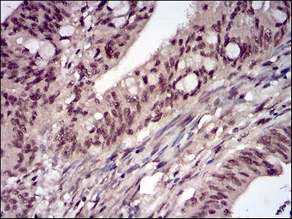 PPP1CB Antibody