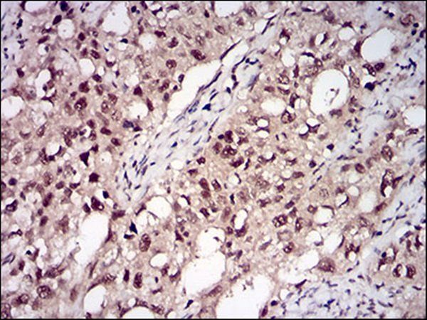 PPP1CB Antibody