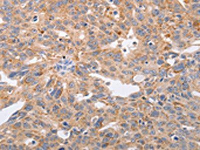 PPP1CB Antibody