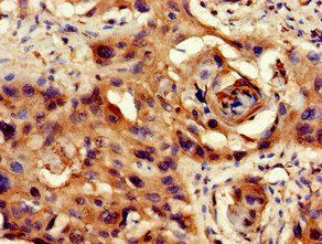 PPP1CB Antibody