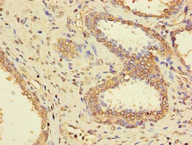 PPP1CC Antibody