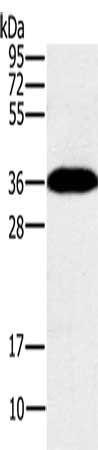 PPP1CC antibody