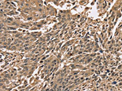 PPP1CC Antibody
