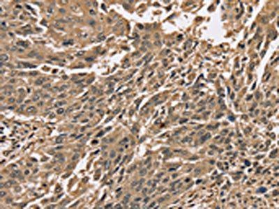 PPP1CC antibody