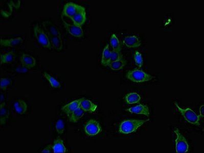 PPP1R12C Antibody