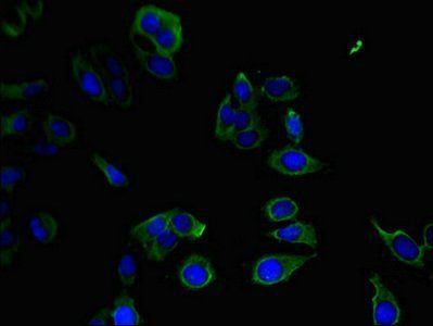 PPP1R12C antibody