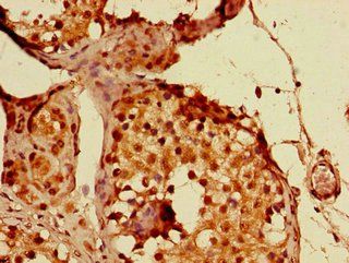 PPP1R13B antibody