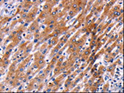 PPP1R13B Antibody