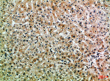 PPP1R13B antibody