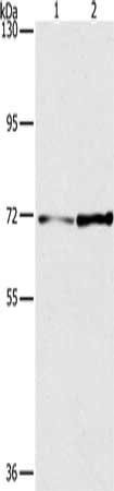 PPP1R13L Antibody