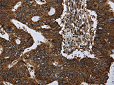 PPP1R13L Antibody