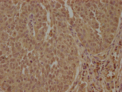 PPP1R13L antibody