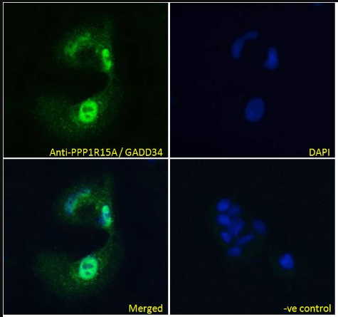 PPP1R15A antibody
