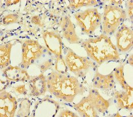 PPP1R16B Antibody