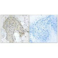 PPP1R2 (Ab-120/121) Antibody