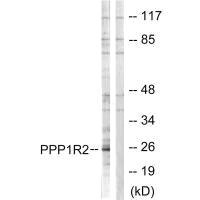 PPP1R2 (Ab-120/121) antibody