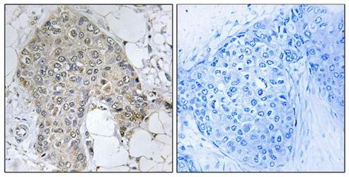 PPP1R2 antibody