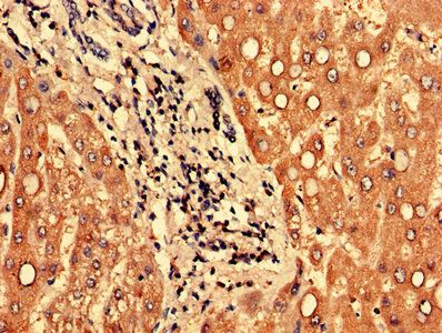 PPP1R3B Antibody