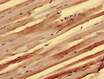 PPP1R3B Antibody