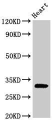 PPP1R3B antibody