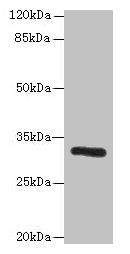 PPP1R3B antibody