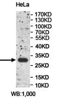 Anti-PPP1R3B Antibody