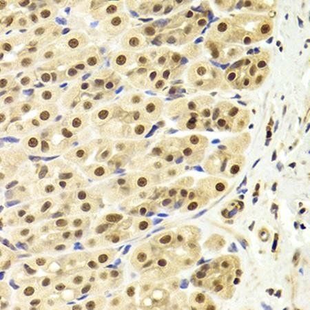 PPP1R8 antibody