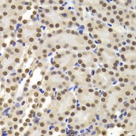 PPP1R8 antibody