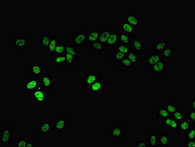 PPP1R8 antibody