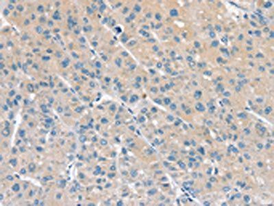 PPP2CA Antibody