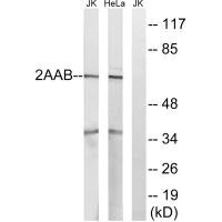 PPP2R1B Antibody