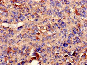 PPP2R2A Antibody