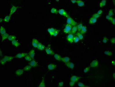PPP2R2B Antibody