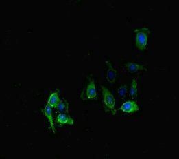 PPP2R2D Antibody