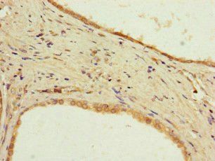PPP2R2D Antibody