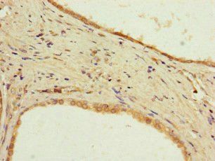 PPP2R2D antibody