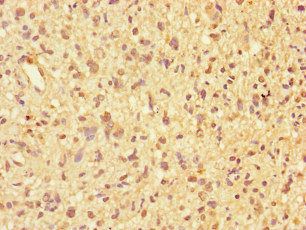 PPP2R2D Antibody