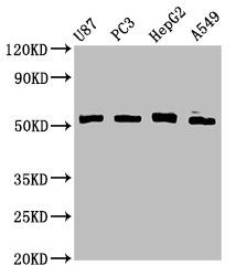 PPP2R2D Antibody