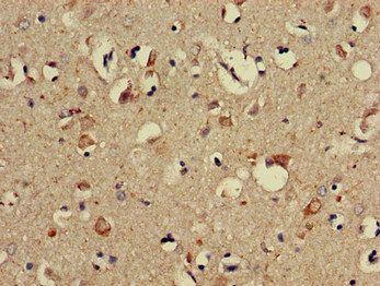 PPP2R3A Antibody