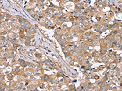 PPP2R3A Antibody
